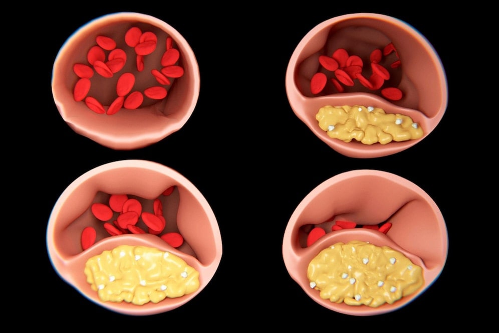 What is Cholesterol