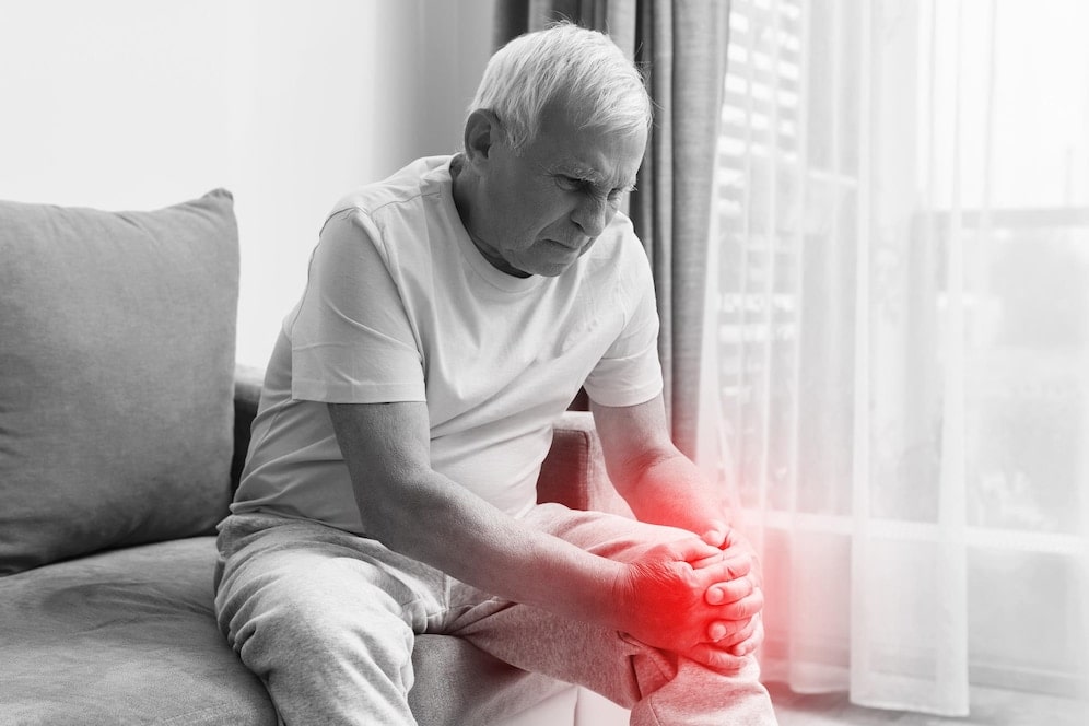 What is arthritis image
