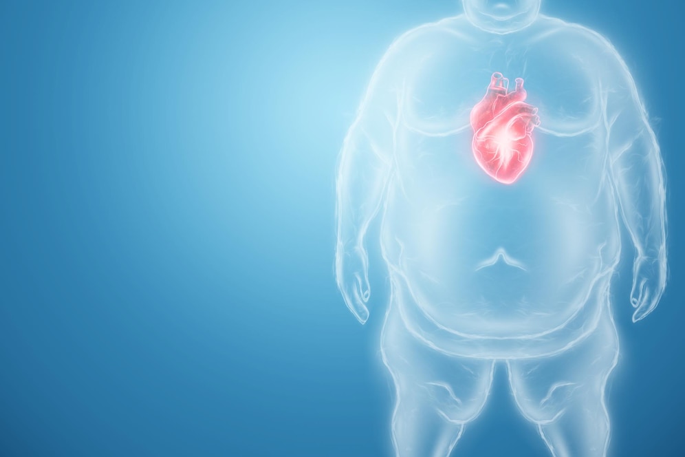 How obesity leads to heart disease | Explained in 3 ways |FAQ