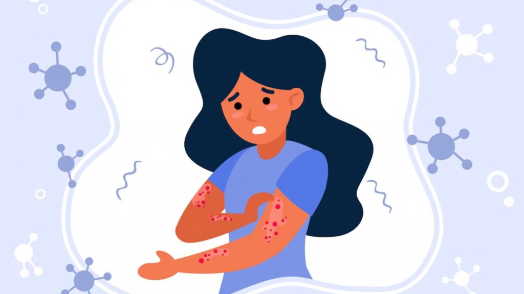 Skin Allergy images