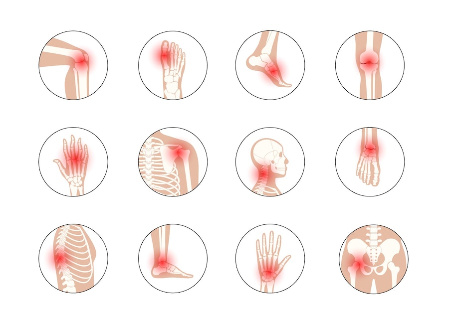 Are there different types of  arthritis?