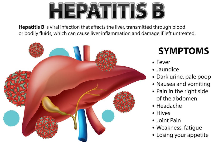 Hepatitis B Treatment and Diagnosis: Virus Treatment of Hepatitis B