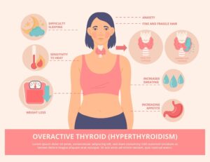 Hyperthyroidism Treatment