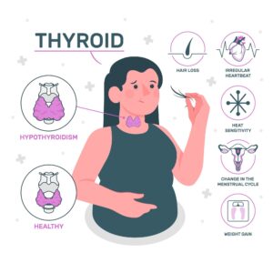 Hypothyroidism Treatment