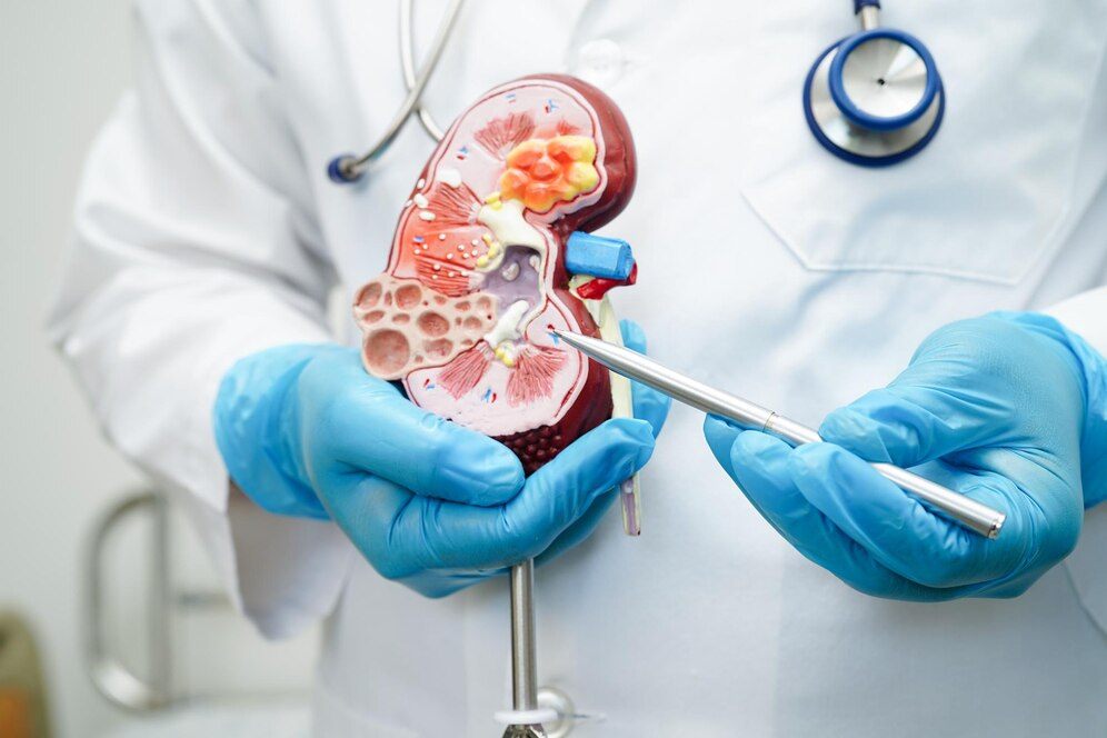 Kidney Stones Treatment – Laser, Ayurvedic Treatment, Side Effects and Home Remedies