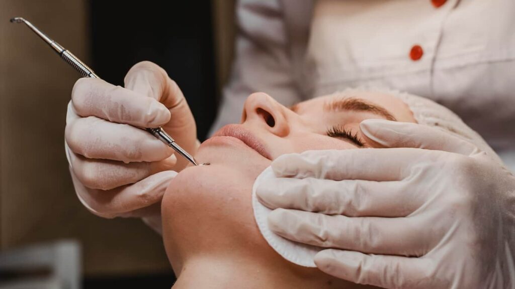 Open Pores Treatment image