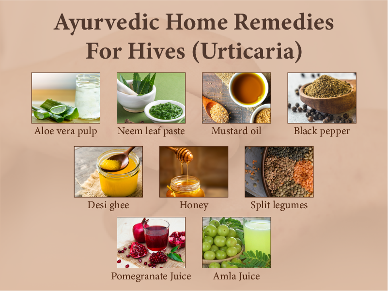 Urticaria Treatment in Hindi