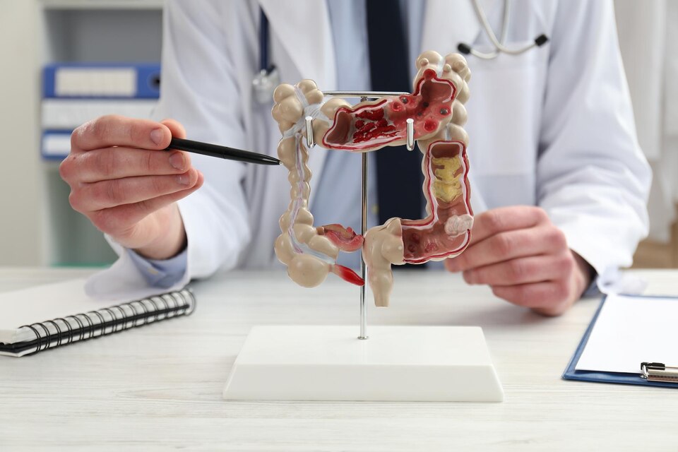 Hernia Treatment: Inguinal Hernia Diagnosis and Treatment