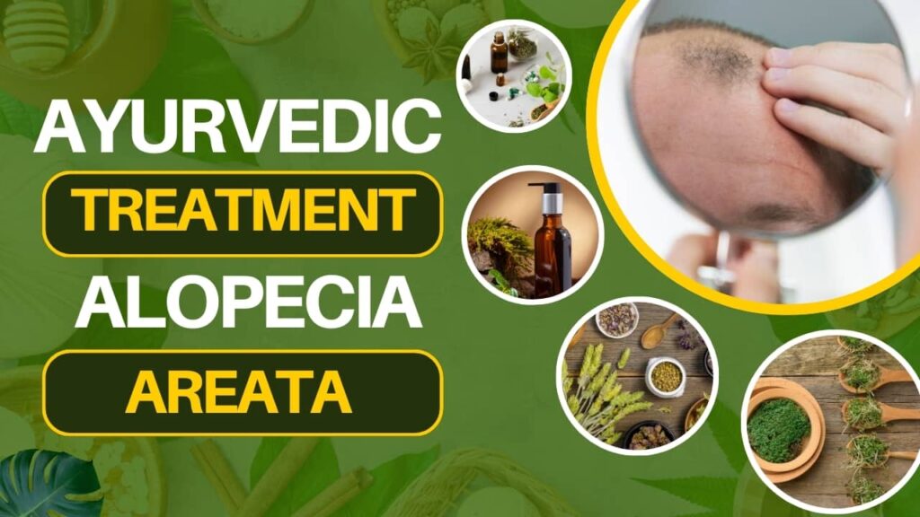alopecia areata treatment image