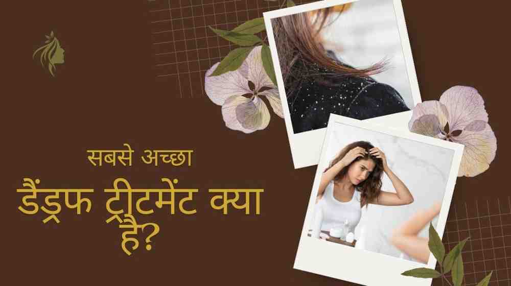 सबसे अच्छा डैंड्रफ ट्रीटमेंट क्या है? Dandruff Treatment in Hindi
