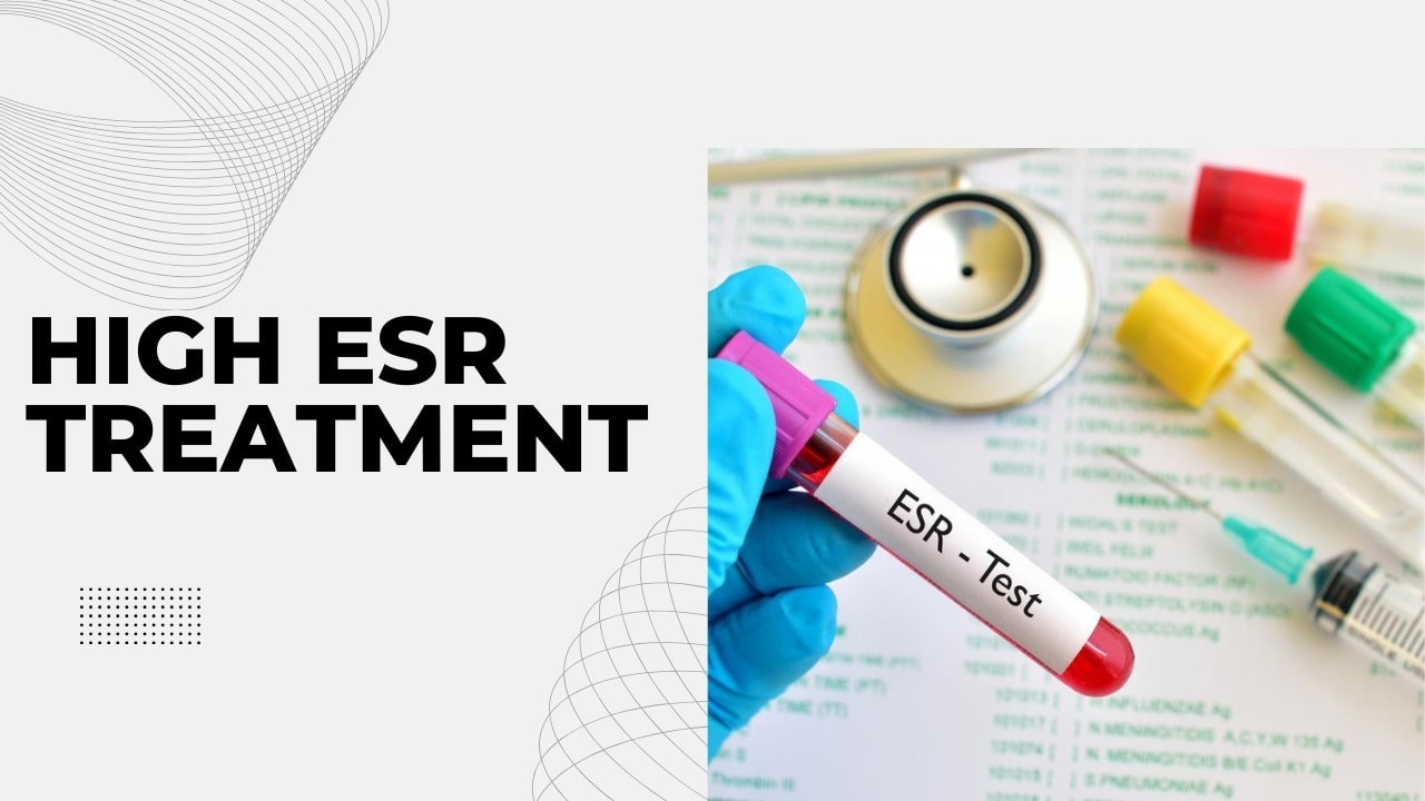 High ESR Treatment: Erythrocyte Sedimentation Rate Treatment