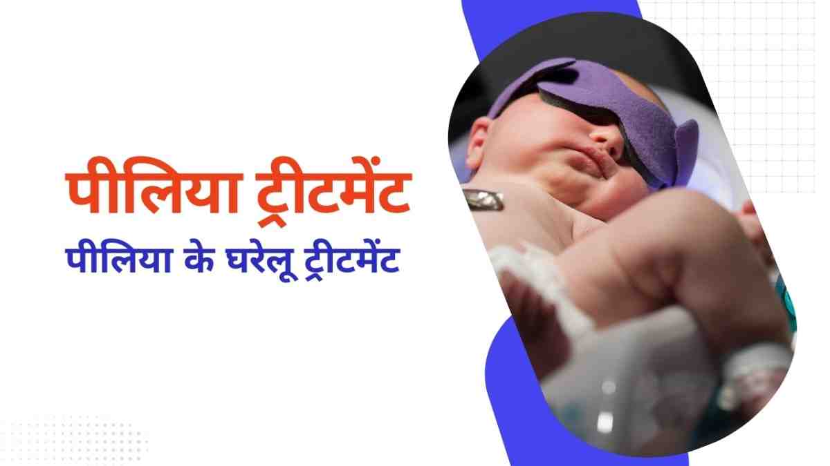 पीलिया ट्रीटमेंट – पीलिया के घरेलू ट्रीटमेंट, Jaundice Treatment in Hindi
