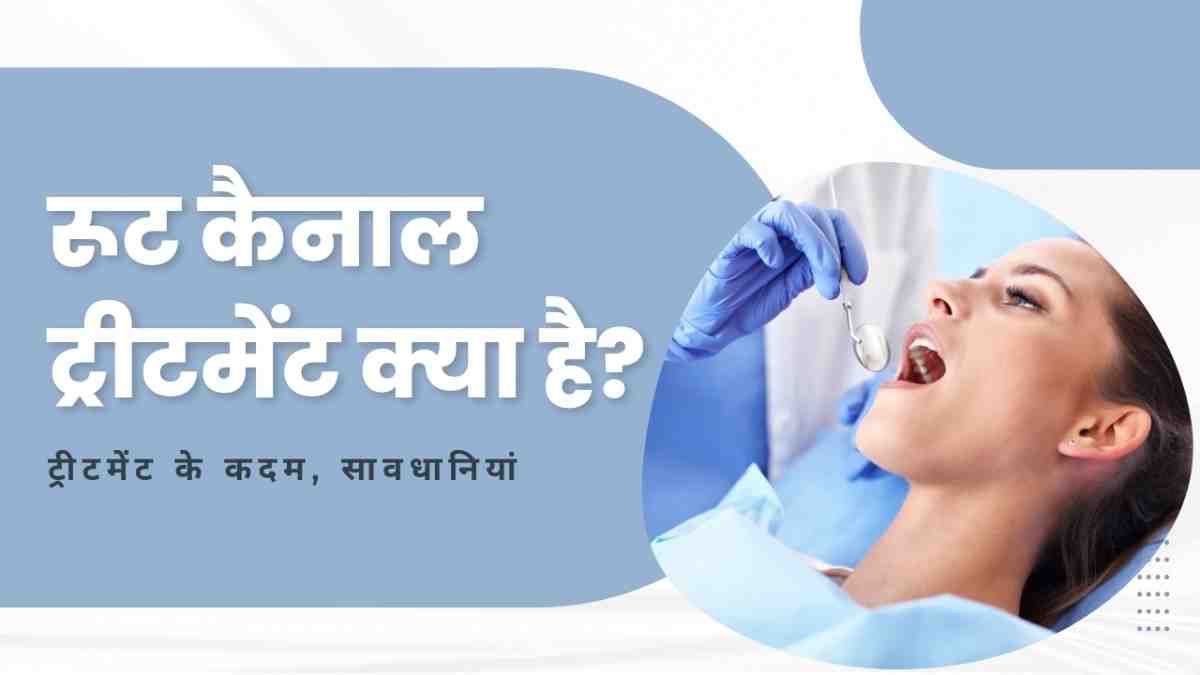 रूट कैनाल  ट्रीटमेंट क्या है? –  ट्रीटमेंट के कदम, सावधानियां, Root Canal Treatment in Hindi