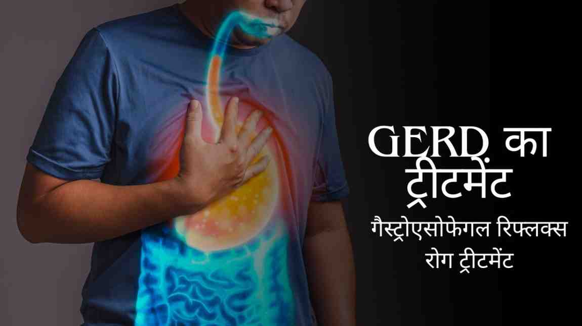 GERD का ट्रीटमेंट – गैस्ट्रोएसोफेगल रिफ्लक्स रोग ट्रीटमेंट, GERD Treatment in Hindi