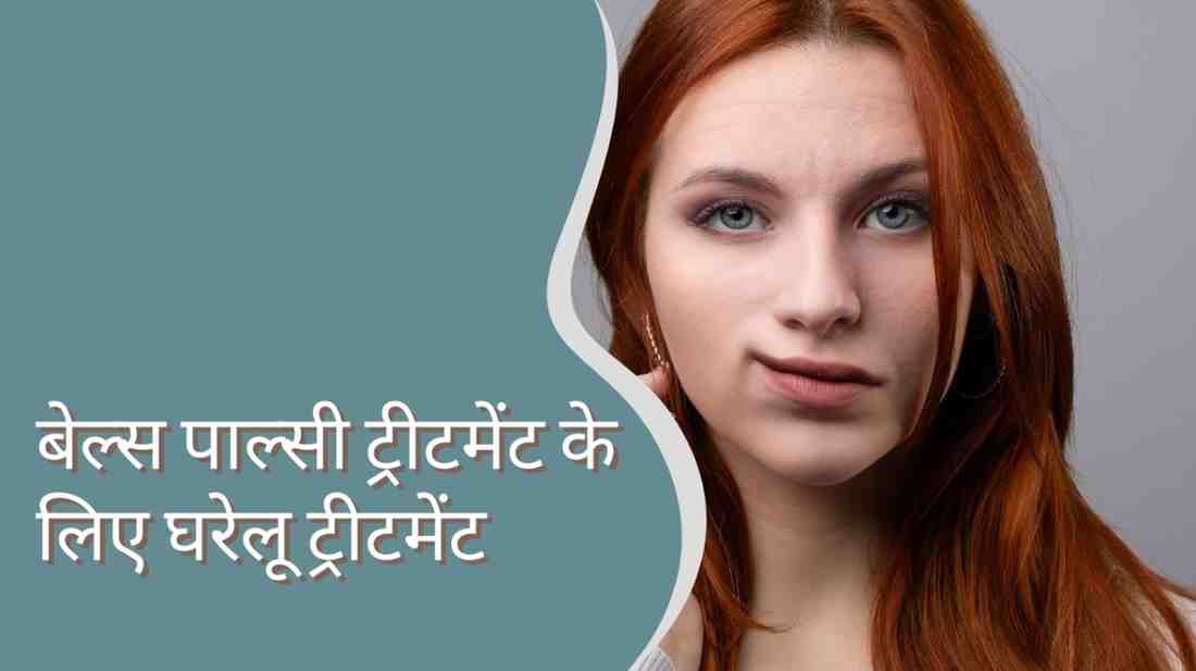 बेल्स पाल्सी ट्रीटमेंट के लिए घरेलू ट्रीटमेंट, Bell’s Palsy Treatment in Hindi