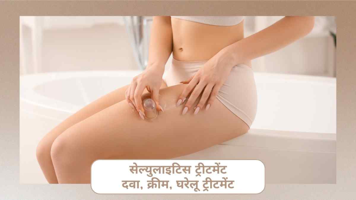 सेल्युलाइटिस ट्रीटमेंट: दवा, क्रीम, घरेलू ट्रीटमेंट, Cellulitis Treatment in Hindi