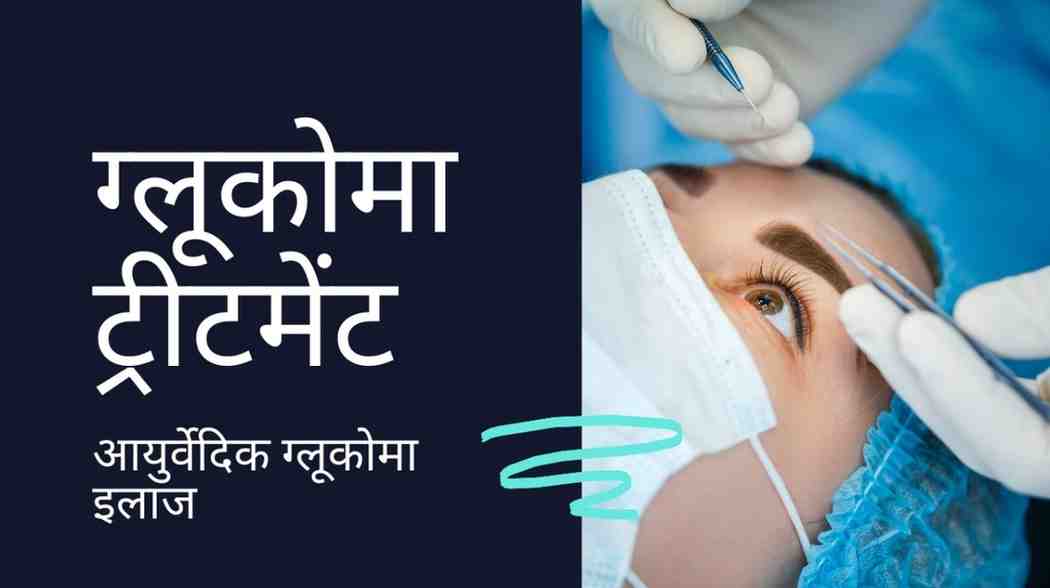 ग्लूकोमा ट्रीटमेंट: आयुर्वेदिक ग्लूकोमा इलाज, Glaucoma Treatment in Hindi