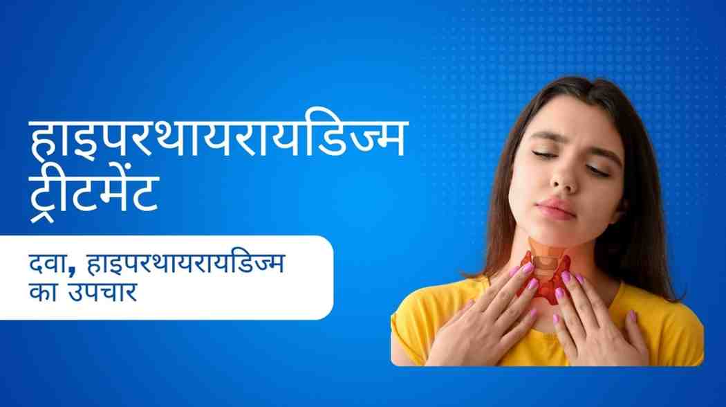 हाइपरथायरायडिज्म ट्रीटमेंट: दवा, हाइपरथायरायडिज्म का उपचार, Hyperthyroidism Treatment in Hindi