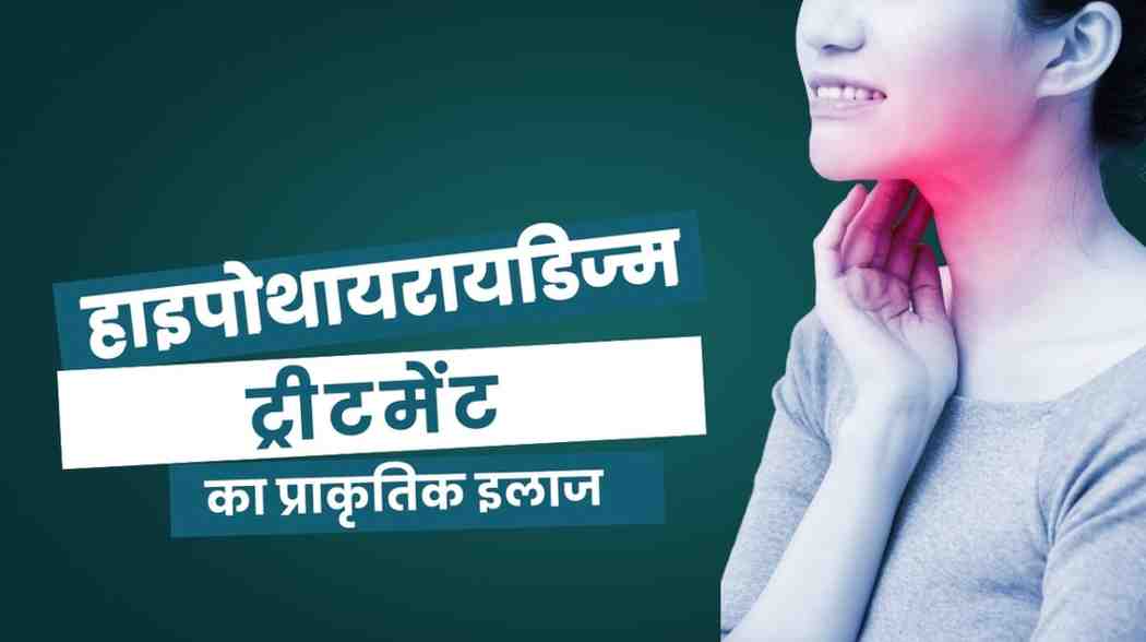 हाइपोथायरायडिज्म ट्रीटमेंट: हाइपोथायरायडिज्म का प्राकृतिक इलाज, Hypothyroidism Treatment in Hindi