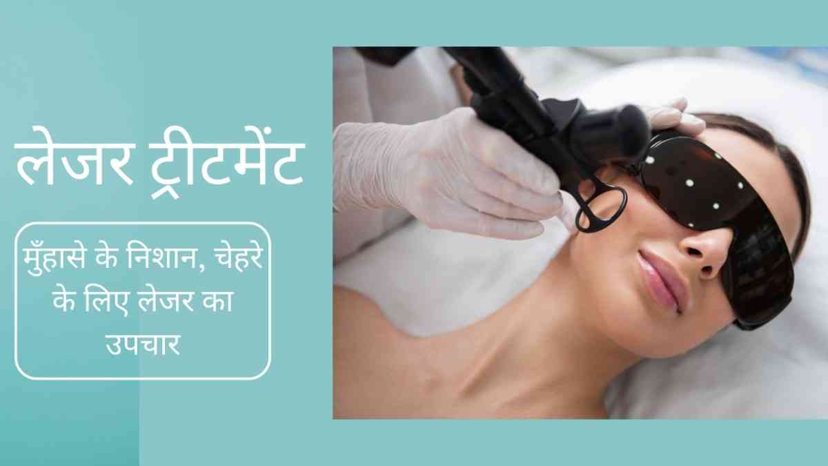 लेजर ट्रीटमेंट: मुँहासे के निशान, चेहरे के लिए लेजर का उपचार, Laser Treatment in Hindi