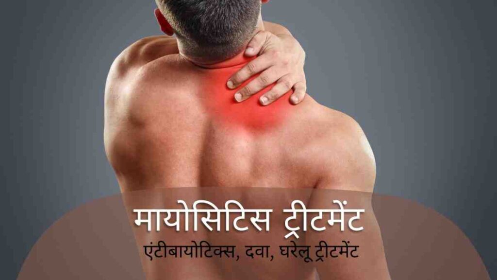myositis treatment in hindi