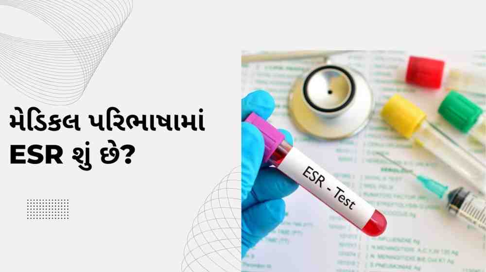 મેડિકલ પરિભાષામાં ESR શું છે? – ESR in Medical Terms in Gujarati