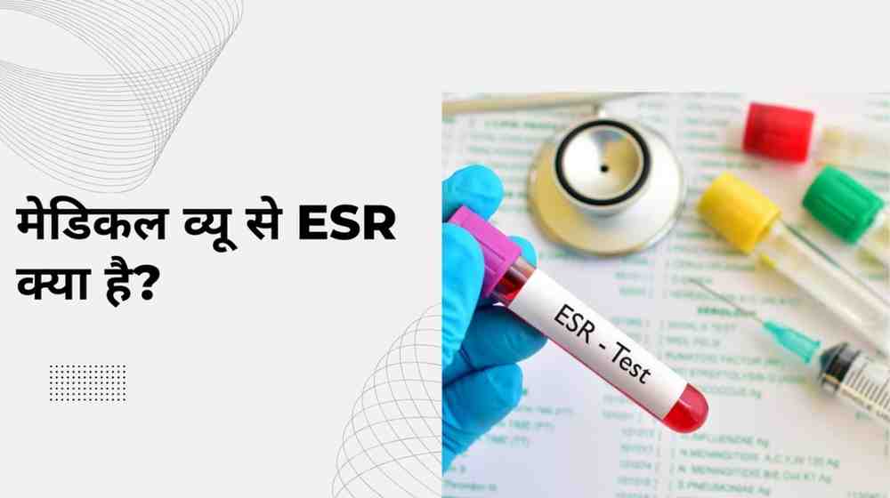 मेडिकल व्यू से ESR क्या है? – ESR in Medical Terms in Hindi