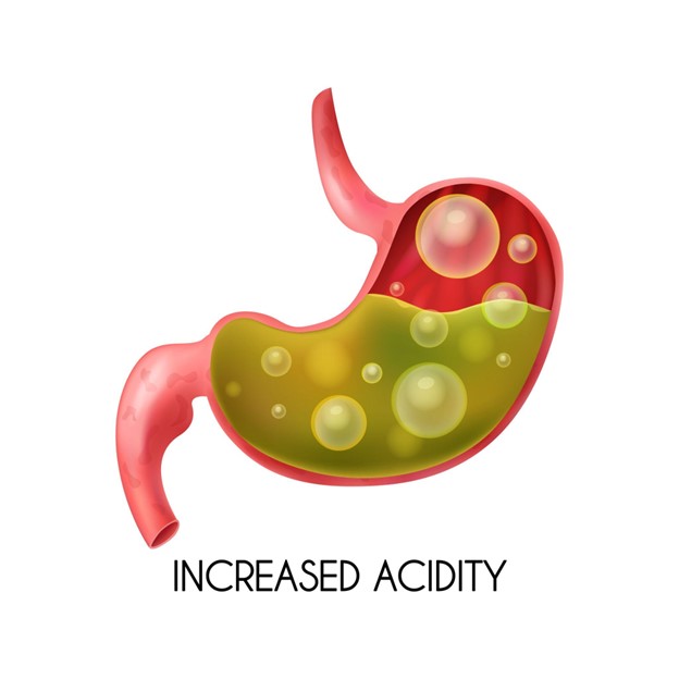 Stomach Ulcer Treatment