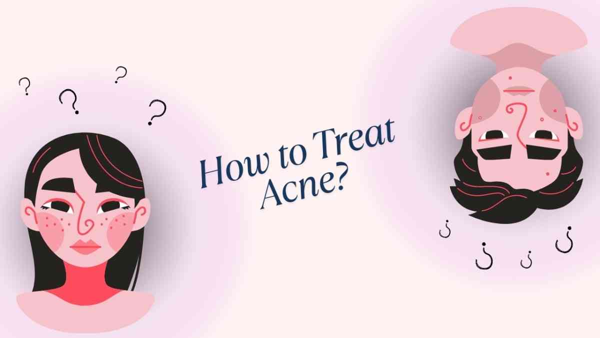 Pimple Treatment – How to Treat Acne?