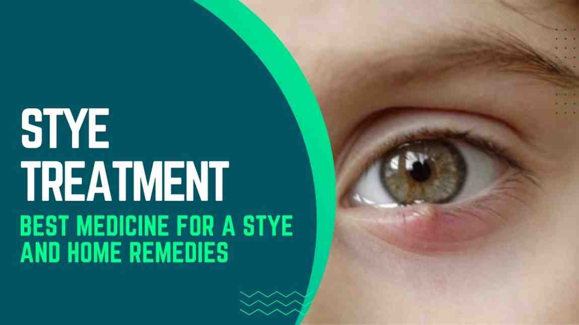 Stye Treatment – Best Medicine for a Stye and Home Remedies