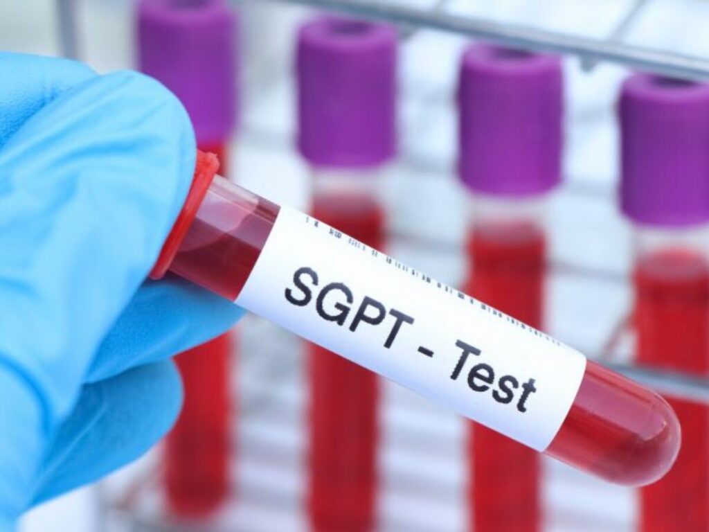 Danger Level Of SGPT and SGOT test image