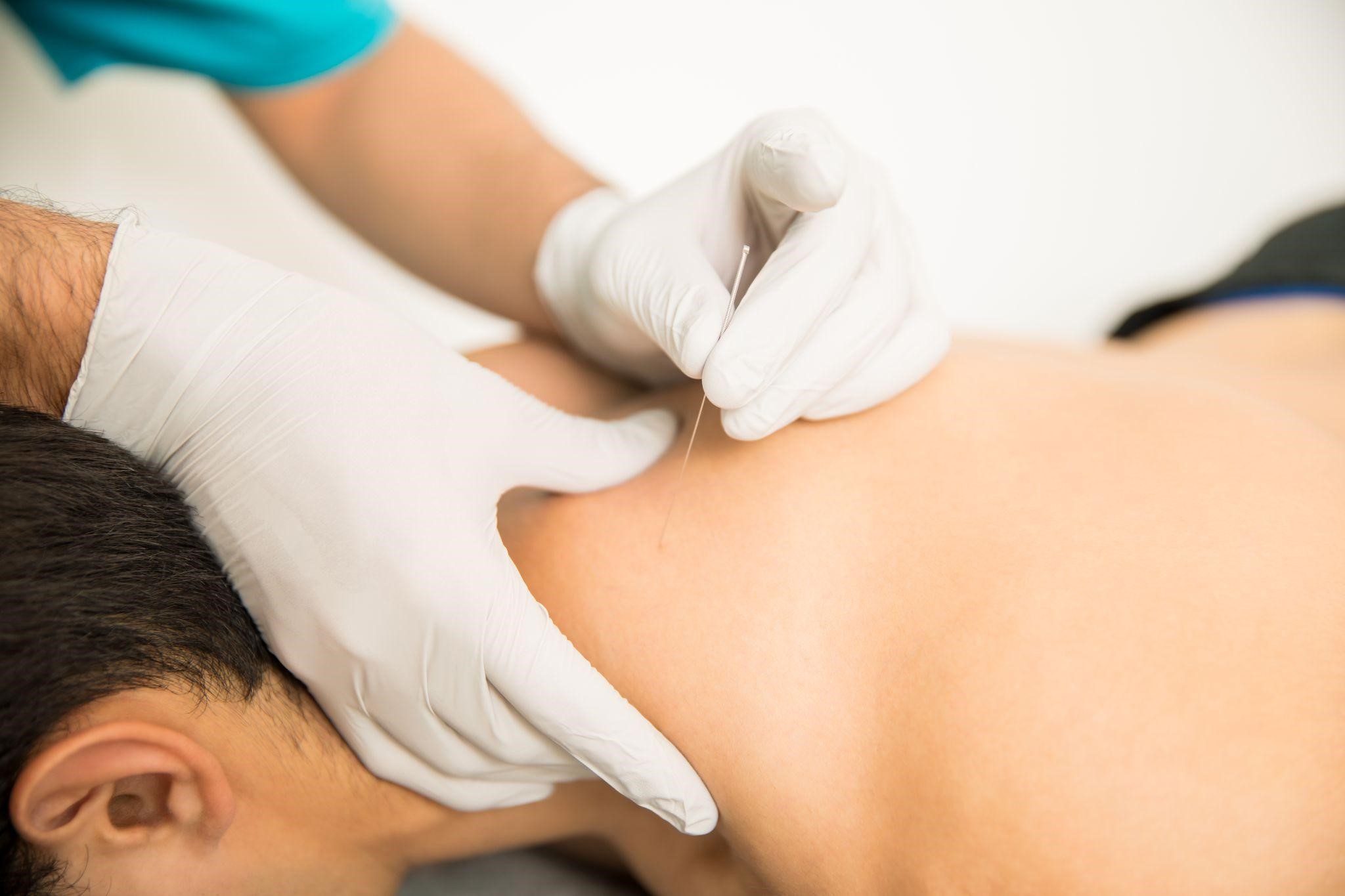 Frozen Shoulder Treatment