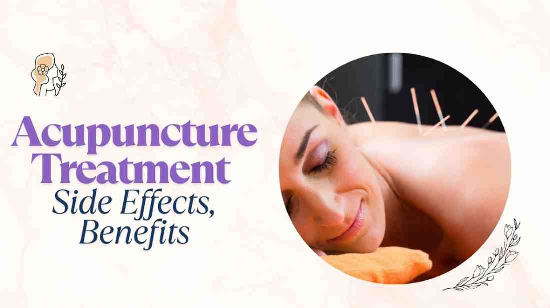 Acupuncture Treatment – Side Effects, Benefits of Acupuncture Treatment