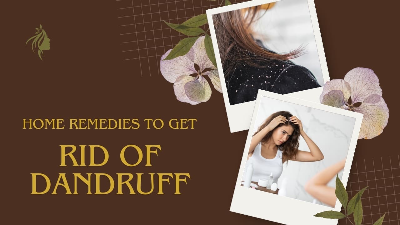 How to get Rid of Dandruff? Home Remedies to get Rid of Dandruff Naturally