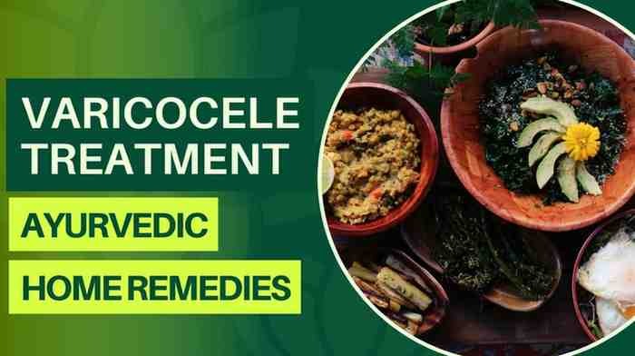 Varicocele Treatment: Ayurveda, Home Remedies and Best Cure for Varicocele