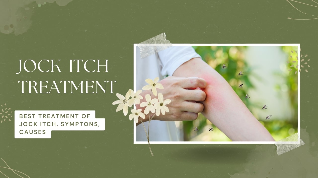 Jock Itch Treatment – Best Treatment of Jock Itch, Symptons, Causes