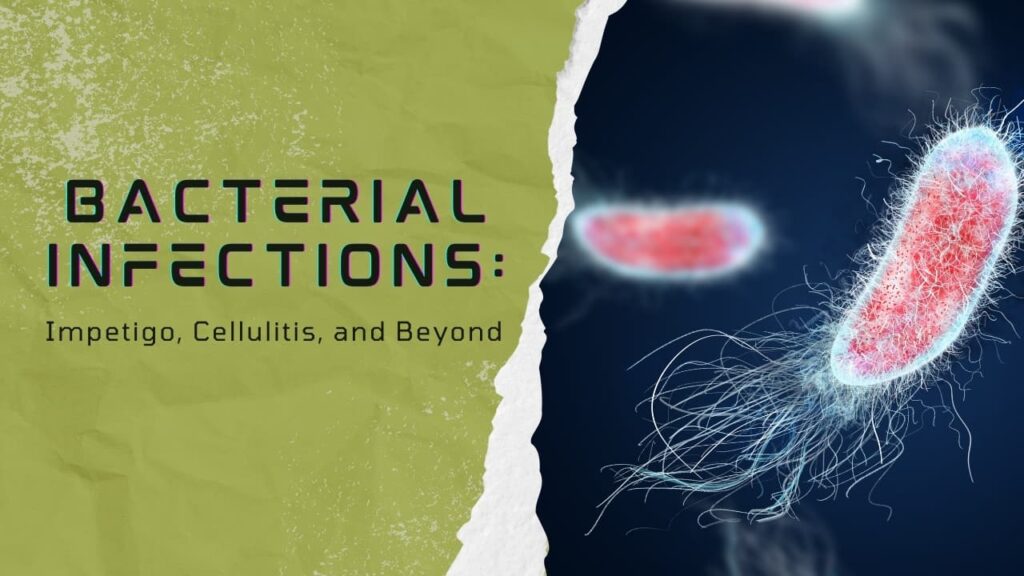 bacterial infections