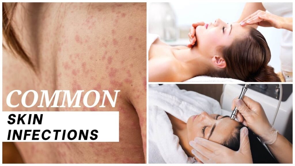 common skin infections