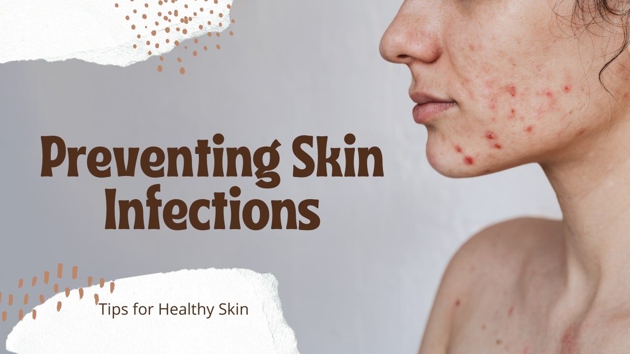 Preventing Skin Infections: Tips for Healthy Skin