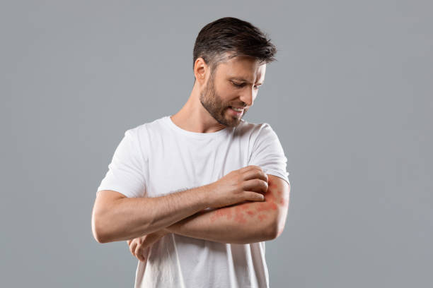 Natural Antifungal Powders: Top Choices for Fungal Skin Protection